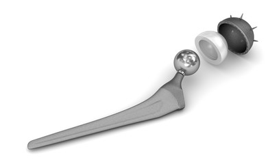 Hip replacement implant isolated on white. Medically accurate 3D illustration