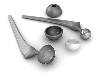 Hip replacement implant isolated on white. Medically accurate 3D illustration