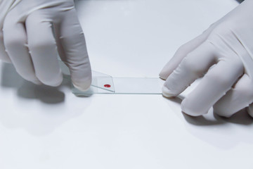 sample for blood smear method