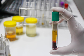 hand holding tube blood sample