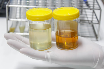 Urine sample