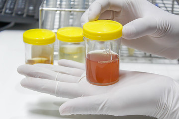 Urine sample