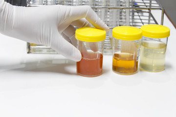 Urine sample