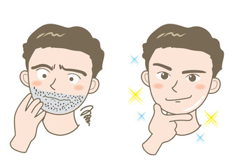 メンズエステ・髭ビフォーアフター