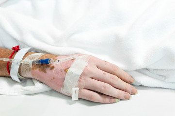 Fototapeta na wymiar selective focus at hand&saline drip - Patient admit in hospital with iv saline