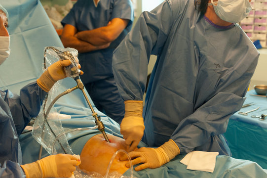 GYNECOLOGICAL SURGERY