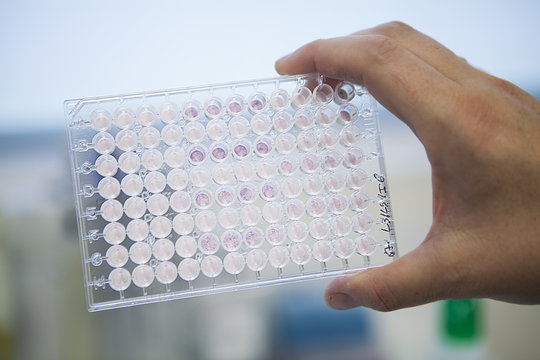 CANCER RESEARCH