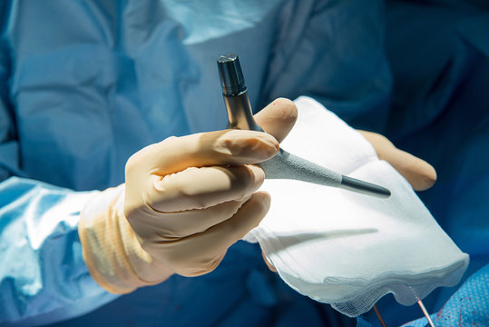 HIP PROSTHESIS, SURGERY