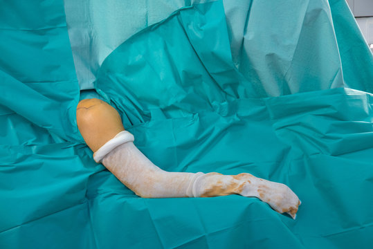 ORTHOPEDIC SURGERY