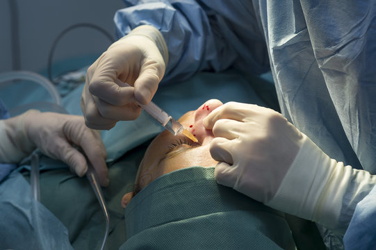 NOSE PLASTIC SURGERY