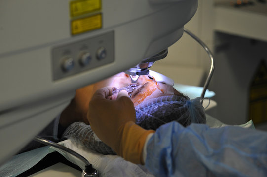 EYE LASER SURGERY