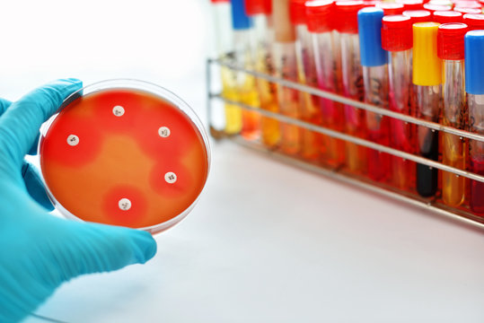 Antimicrobial susceptibility testing in petri dish