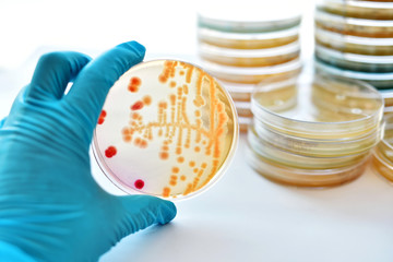 Colonies of bacteria in petri dish (MacConkey agar)
