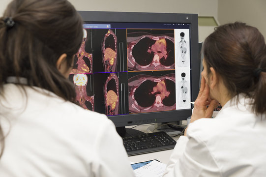 PETSCAN
