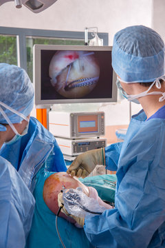 SHOULDER, ARTHROSCOPY