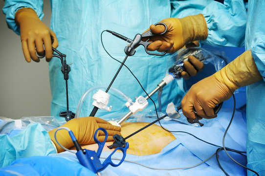 SURGERY, COELIOSCOPY