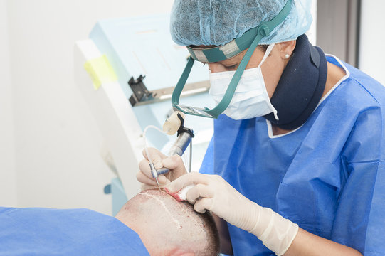 HAIR TRANSPLANTATION