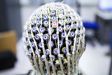 Close-up of patient's head covered with electrodes