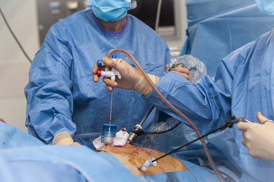 GYNECOLOGICAL SURGERY