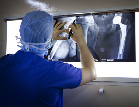 HIP PROSTHESIS, SURGERY