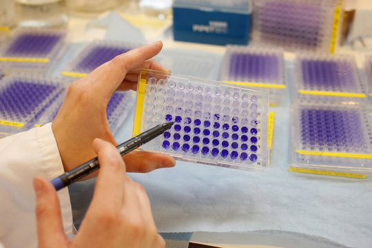 AIDS, RESEARCH