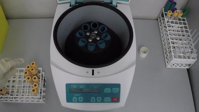 Vortex mixer in bio lab