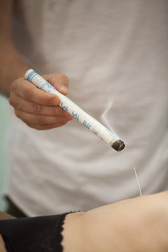 ACUPUNCTURE