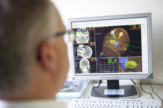 PROTONTHERAPY