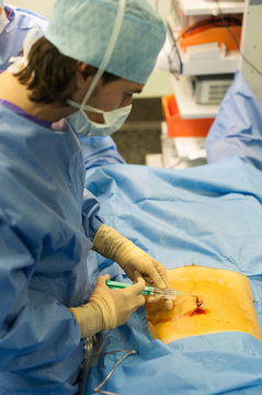 GYNECOLOGICAL SURGERY