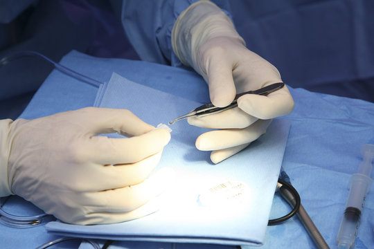CATARACT, SURGERY