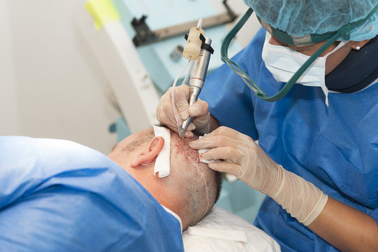 HAIR TRANSPLANTATION