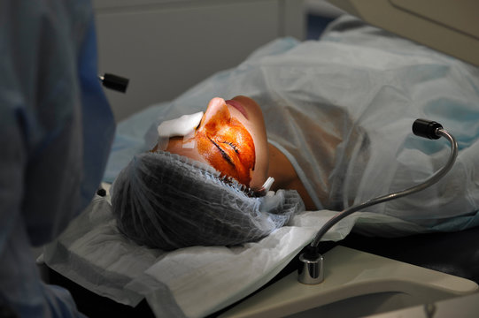 EYE LASER SURGERY