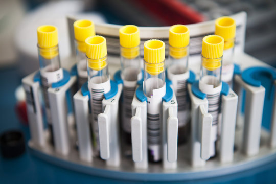 ANALYSIS LABORATORY