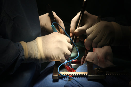 HEART SURGERY