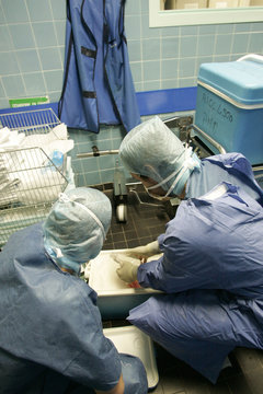 HEART TRANSPLANT