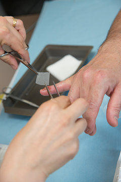 PARONYCHIA CARE
