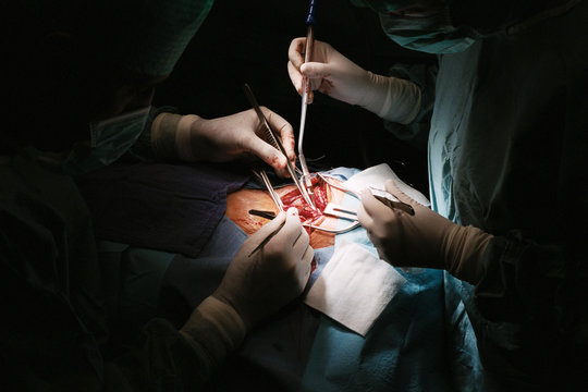 SURGERY