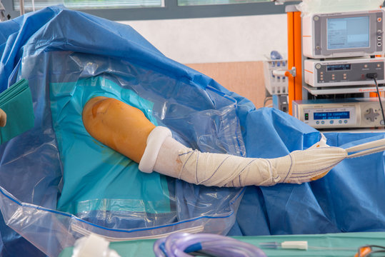 SHOULDER, ARTHROSCOPY
