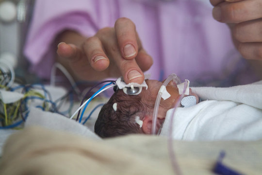 NEONATOLOGY