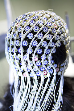 Close-up of patient's head covered with electrodes of EEG