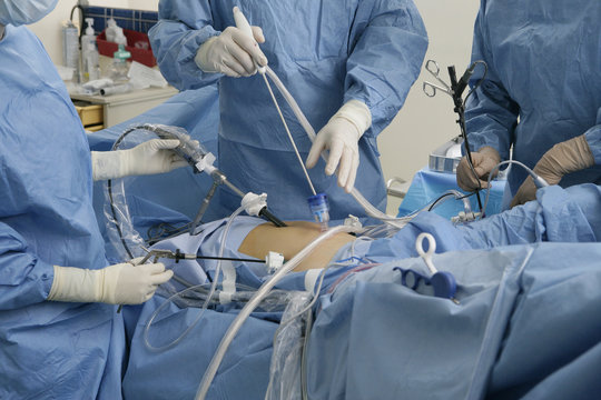 MYOMECTOMY