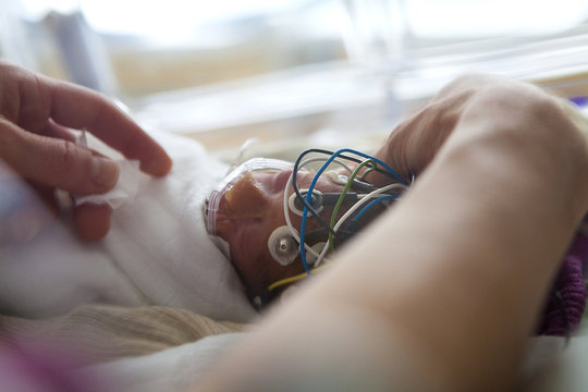 NEONATOLOGY