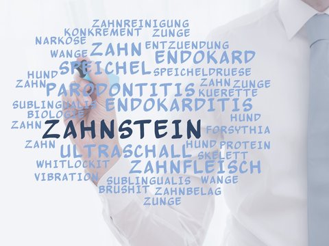 Zahnstein