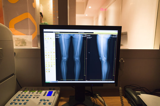 EOS X-RAY IMAGING