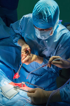 HIP PROSTHESIS, SURGERY