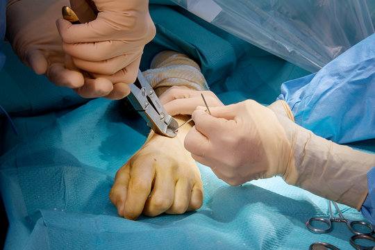 ORTHOPEDIC SURGERY