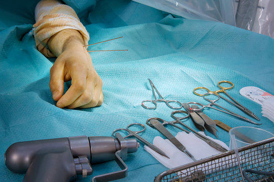 ORTHOPEDIC SURGERY