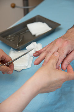 PARONYCHIA CARE