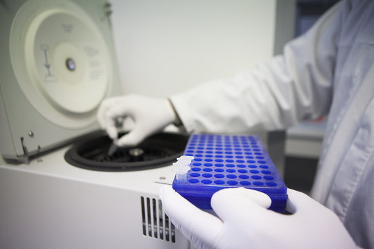 AIDS, RESEARCH