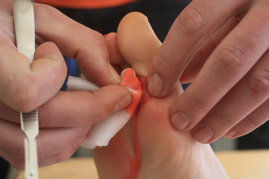 SPORTS MEDICINE